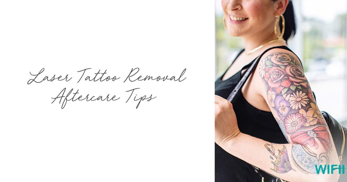 Laser Tattoo Removal Aftercare Tips - WIFH