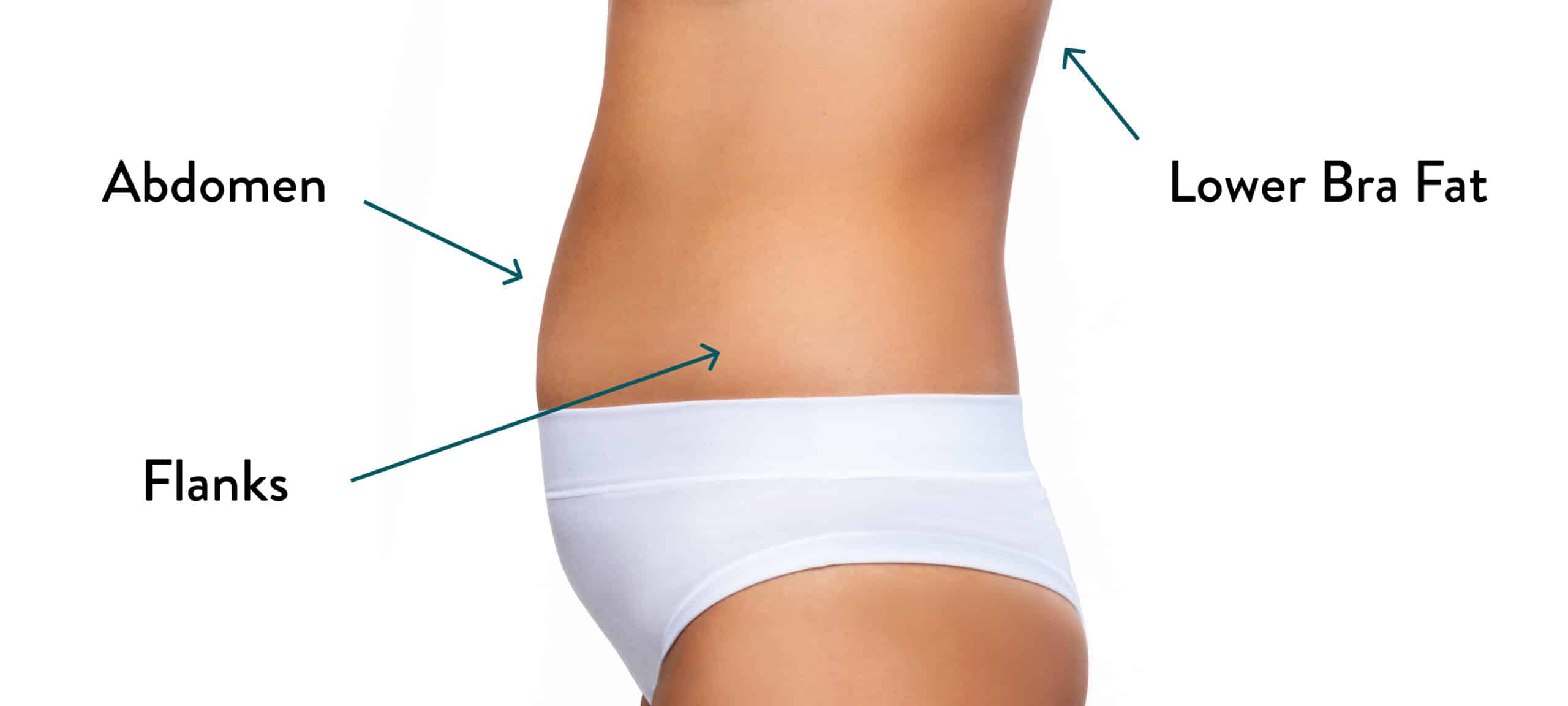 Should I get a second opinion 1.5 weeks after inner thigh lipo and